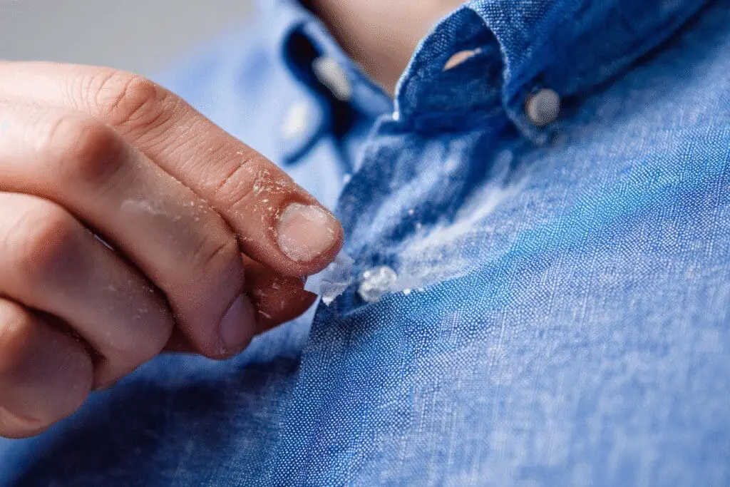 A close-up demonstrating how to get off sticker residue from clothes using a gentle cleaning method
