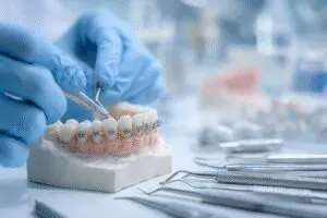 Facts answered about how long it takes to get braces on, showing an orthodontist applying a bracket to a dental model